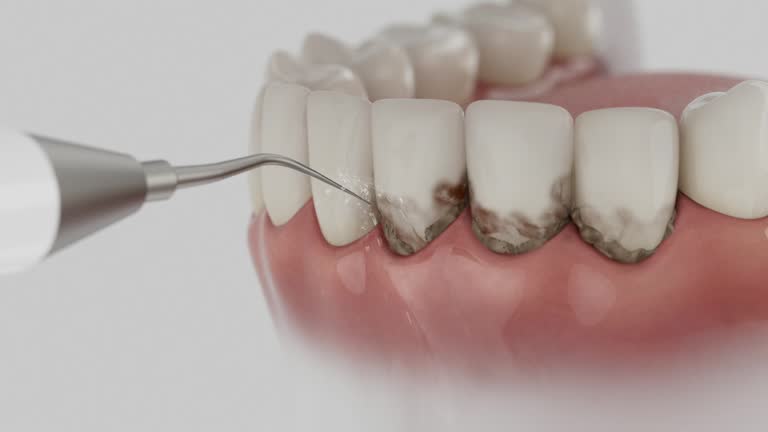 Reliable Dental contractor in Ironton, OH by Dentist Open Now